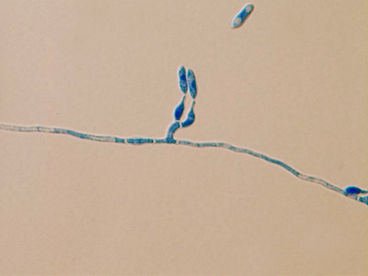 Cordyceps lepidopterorum